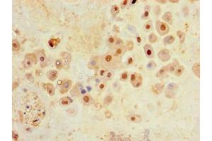 Immunohistochemistry of paraffin-embedded human placenta tissue using ABIN7176688 at dilution of 1:100 (SLC3A8 (AA 320-369) Antikörper)