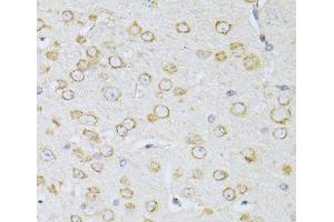 Immunohistochemistry of paraffin-embedded Mouse brain using NTS Polyclonal Antibody at dilution of 1:100 (40x lens). (Neurotensin Antikörper)