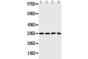 Anti-Carbonic Anhydrase III antibody, Western blotting Lane 1: SMMC Cell Lysate Lane 2: HELA Cell Lysate Lane 3: SW620 Cell Lysate Lane 4: SCG Cell Lysate
