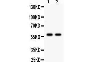 Western Blotting (WB) image for anti-Cytochrome P450, Family 1, Subfamily A, Polypeptide 2 (CYP1A2) (AA 185-320) antibody (ABIN3043820)