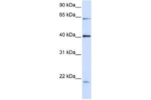 C19ORF46 antibody used at 1 ug/ml to detect target protein. (C19orf46 Antikörper  (N-Term))