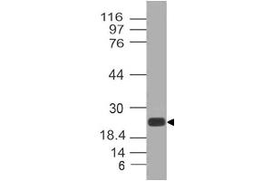 Image no. 1 for anti-C-Type Lectin Domain Family 4, Member E (CLEC4E) antibody (ABIN5026978)