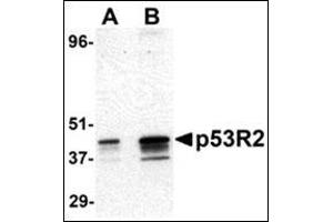 Western blot analysis of p53R2 expression in A431 cell lysate with this product at (A) 0. (RRM2B Antikörper  (N-Term))