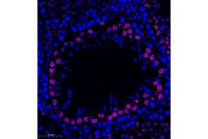 Immunofluorescence (Paraffin-embedded Sections) (IF (p)) image for anti-Hepatoma-Derived Growth Factor-Related Protein 3 (HDGFRP3) antibody (ABIN7074198)