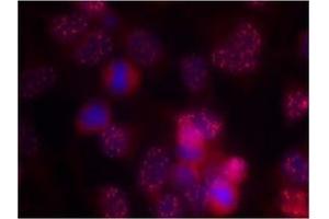 Image no. 2 for anti-Protein Kinase C, delta (PKCd) (AA 643-647) antibody (ABIN197564) (PKC delta Antikörper  (AA 643-647))