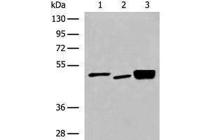 Western blot analysis of 293T cell Human cerebrum tissue and Mouse brain tissue lysates using DMTN Polyclonal Antibody at dilution of 1:550 (Dematin Antikörper)