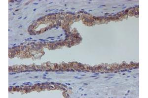 Image no. 1 for anti-Estrogen Receptor 1 (ESR1) antibody (ABIN1498060) (Estrogen Receptor alpha Antikörper)