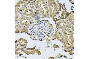 Immunohistochemistry of paraffin-embedded rat kidney using CDH6 antibody (ABIN5974784) at dilution of 1/100 (40x lens). (CDH6 Antikörper)