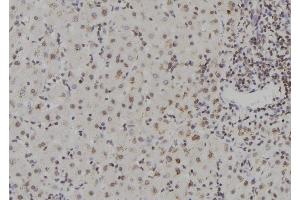 ABIN6273567 at 1/100 staining Human liver tissue by IHC-P. (ZNF709 Antikörper  (N-Term))