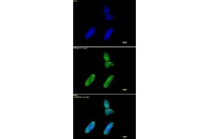Histone H3 acetyl Lys9 antibody tested by immunofluorescence.