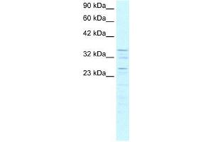 Human K562; WB Suggested Anti-ZNF385 Antibody Titration: 0.
