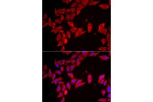 Immunofluorescence analysis of HeLa cell using SLC35A2 antibody.