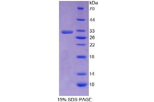 SDS-PAGE analysis of Human SHP Protein.