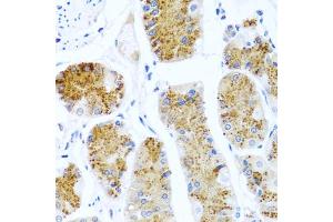 Immunohistochemistry of paraffin-embedded human stomach using C8orf4 antibody (ABIN5975014) at dilution of 1/100 (40x lens). (C8orf4 Antikörper)