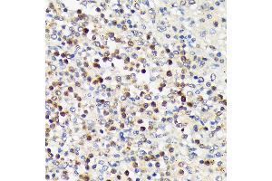 Immunohistochemistry of paraffin-embedded human spleen using CD5 Rabbit mAb (ABIN7266206) at dilution of 1:100 (40x lens). (CD5 Antikörper)