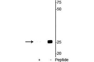 Western blot of mouse heart lysate showing specific immunolabeling of the ~25 kDa cardiac troponin I protein phosphorylated at Ser23/24 in the second lane (-). (TNNI3 Antikörper  (pSer23, pSer24))
