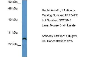 WB Suggested Anti-Frg1  Antibody Titration: 0. (FRG1 Antikörper  (Middle Region))