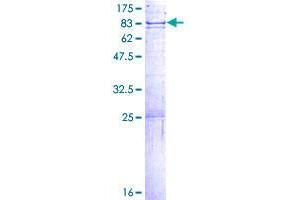 Image no. 1 for DNA Cross-Link Repair 1B (DCLRE1B) (AA 1-532) protein (GST tag) (ABIN1351197) (DCLRE1B Protein (AA 1-532) (GST tag))