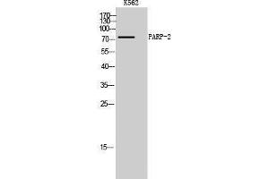 Western Blotting (WB) image for anti-Poly (ADP-Ribose) Polymerase 2 (PARP2) (Internal Region) antibody (ABIN3186334)