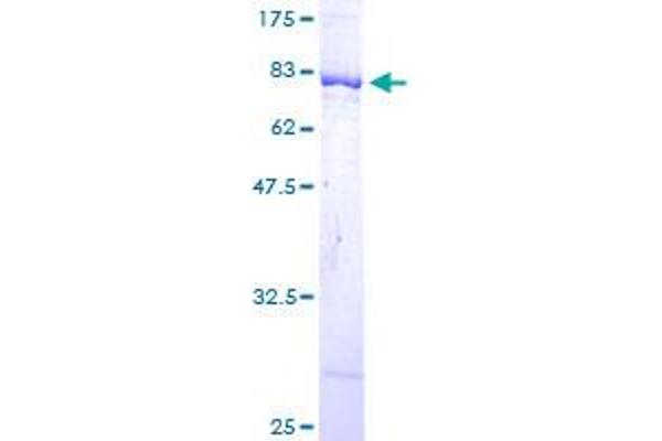 DARS Protein (AA 1-501) (GST tag)