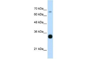 WB Suggested Anti-THOC3 Antibody Titration:  0. (THO Complex 3 Antikörper  (Middle Region))