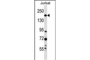Western blot analysis in Jurkat cell line lysates (35ug/lane). (UGGT1 Antikörper  (C-Term))