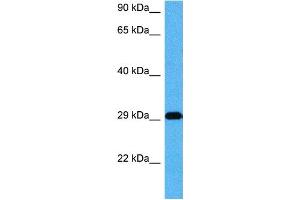 Host:  Mouse  Target Name:  CDX2  Sample Tissue:  Mouse Skeletal Muscle  Antibody Dilution:  1ug/ml (CDX2 Antikörper  (Middle Region))