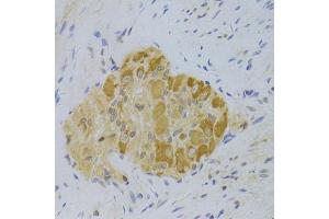 Immunohistochemistry of paraffin-embedded human rectum using PA2G4 Antibody (ABIN5973112) at dilution of 1/100 (40x lens). (PA2G4 Antikörper)