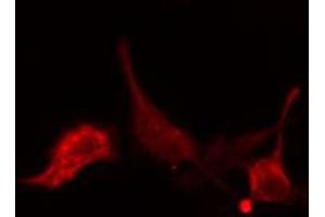 ABIN6274769 staining LOVO cells by IF/ICC. (RPL15 Antikörper  (C-Term))
