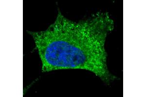 Fluorescent confocal image of SY5Y cells stained with NGFR antibody SY5Y cells were fixed with 4 % PFA (20 min), permeabilized with Triton X-100 (0. (NGFR Antikörper)