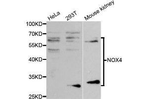 Western blot analysis of extracts of various cell lines, using NOX4 antibody. (NADPH Oxidase 4 Antikörper)