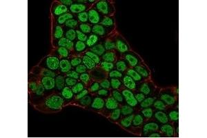 Immunofluorescence staining of PFA-fixed MCF-7 cells with MSH6 Mouse Monoclonal Antibody (MSH6/3086) followed by goat anti-mouse IgG-CF488 (green). (MSH6 Antikörper  (AA 374-540))