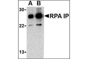 Western blot analysis of RPA Interacting Protein in Jurkat cell lysate with this product at (A) 0. (RPAIN Antikörper  (C-Term))