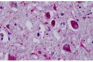 Anti-PPYR1 antibody IHC staining of human brain, substania nigra. (NPY4R Antikörper  (Cytoplasmic Domain))