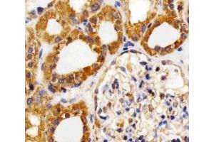 Immunohistochemistry (IHC) image for anti-Fms-Related Tyrosine Kinase 4 (FLT4) antibody (ABIN3030977)