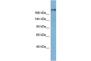 WB Suggested Anti-LAMB1 Antibody Titration:  0. (Laminin beta 1 Antikörper  (Middle Region))