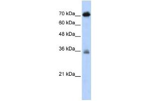 WB Suggested Anti-NKRF Antibody Titration:  0. (NKRF Antikörper  (N-Term))