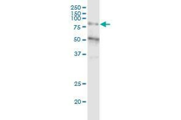 ZFP14 Antikörper  (AA 70-161)