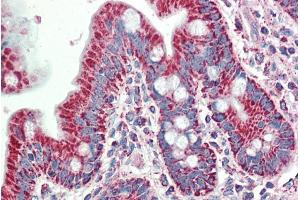 ABIN1590031 (5µg/ml) staining of paraffin embedded Human Small Intestine. (SLAMF8 Antikörper  (Internal Region))