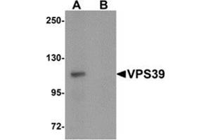 Western blot analysis of VPS39 in rat liver tissue lysate with VPS39 antibody at 0. (VPS39 Antikörper  (C-Term))