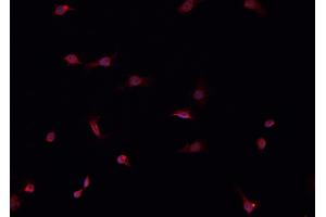 ABIN6266520 staining HeLa  cells by IF/ICC.