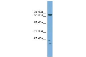 WB Suggested Anti-MRE11A  Antibody Titration: 0. (Mre11 Antikörper  (N-Term))