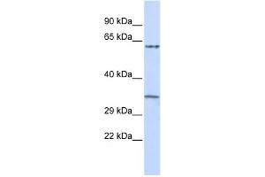 WB Suggested Anti-TRIM8 Antibody Titration:  0. (TRIM8 Antikörper  (Middle Region))