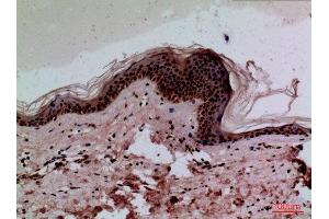 Immunohistochemistry (IHC) analysis of paraffin-embedded Human Skin, antibody was diluted at 1:100. (CEACAM1/5 Antikörper  (N-Term))