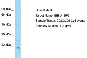 Host: Rabbit Target Name: EBNA1BP2 Sample Type: COLO205 Whole Cell lysates Antibody Dilution: 1.