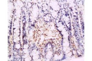 Formalin-fixed and paraffin embedded rat colon tissue labeled with Anti-P-selectin Polyclonal Antibody , Unconjugated at 1:200, followed by conjugation to the secondary antibody and DAB staining (P-Selectin Antikörper  (AA 701-768))