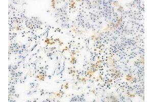ABIN6263841 and ABIN6272768 at 1/100 staining human pituitary adenoma by IHC-P.