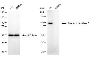 Western blotting analysis using dipeptidyl peptidase 8 antibody (ABIN7798346). (DPP8 Antikörper)