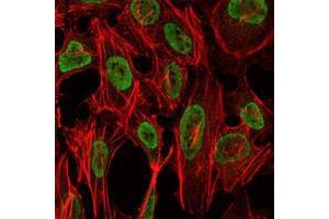 Immunofluorescence analysis of NIH/3T3 cells using PSIP1 mouse mAb (green). (PSIP1 Antikörper)