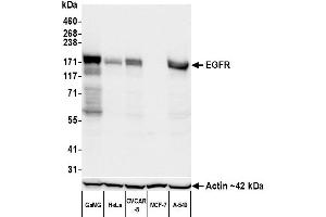Western Blotting (WB) image for anti-Epidermal Growth Factor Receptor (EGFR) (AA 1100-1150) antibody (ABIN7795641)